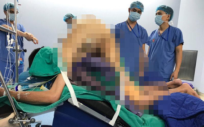 Bệnh viện 108 chỉnh thẳng 'lưng tôm' cho người đàn ông bị gù 22 năm ảnh 1