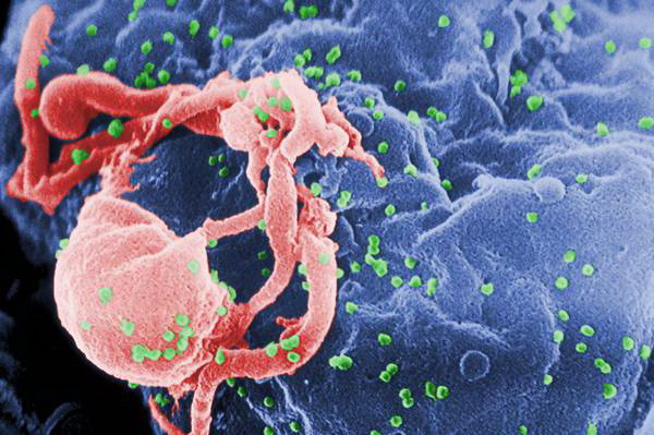 Italy và Nam Phi hợp tác nghiên cứu vắcxin điều trị HIV/AIDS ảnh 1