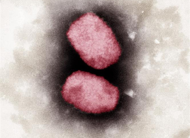 ECDC: Thế giới đã ghi nhận hơn 200 ca mắc bệnh đậu mùa khỉ ảnh 1