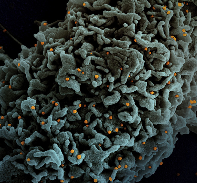 Dịch COVID-19: Mối đe dọa mới từ biến chủng mang tên Lambda ảnh 1