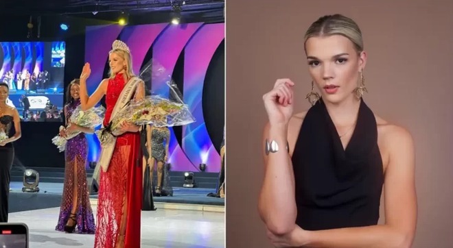 Người đẹp da trắng gây tranh cãi khi trở thành Hoa hậu Zimbabwe ảnh 1