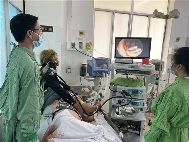 Cứu sống bệnh nhân xuất huyết tiêu hóa dưới ồ ạt bằng kẹp clip cầm máu ảnh 1