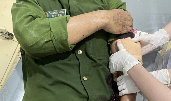 Bắt giữ kẻ vi phạm quy định phòng dịch, chém trọng thương công an ảnh 1