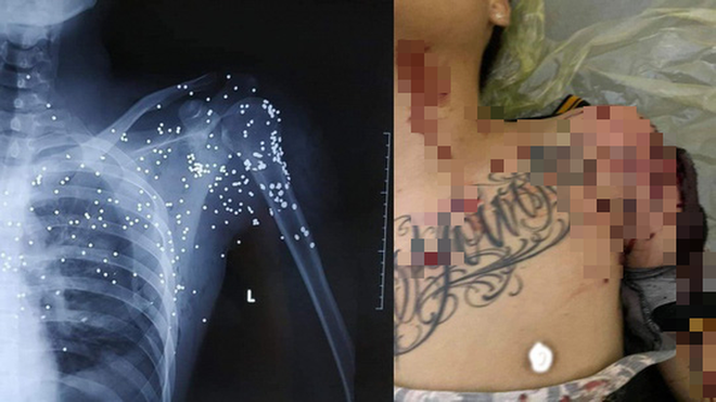 Vụ nổ súng tại trạm BOT ở Thái Bình: Đối tượng gây án đã ra đầu thú ảnh 1