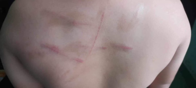 Thanh Hóa: Tạm đình chỉ cô giáo dùng roi tre đánh học trò ảnh 1