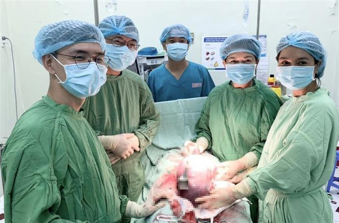 Các bác sỹ thực hiện ca phẫu thuật thành công. (Ảnh: TTXVN phát) Cứu sống sản phụ bị tiền sản giật do khối u buồng trứng nặng 4kg ảnh 1