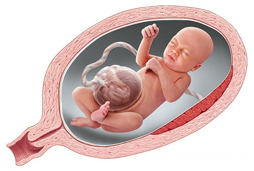 Phẫu thuật thành công cho bé mới sinh 3 giờ mắc bệnh hiếm gặp ảnh 1