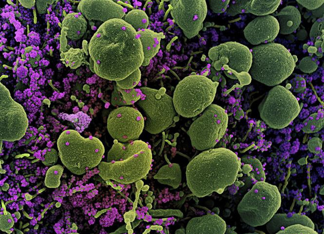 WHO thông báo về biến thể mới IHU phát hiện lần đầu tiên ở Pháp ảnh 1