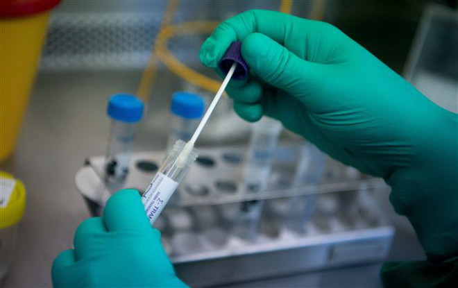 Nghiên cứu viên làm việc trên mẫu bệnh phẩm chứa virus corona chủng mới 2019-nCoV tại phòng thí nghiệm ở Stuttgart, miền Nam Đức ngày 29/1/2020. (Ảnh: AFP/TTXVN) Chạy đua với thời gian để điều chế vắcxin phòng chống nCoV ảnh 1