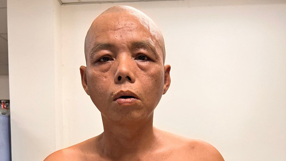 Thành phố Hồ Chí Minh: Bắt giữ đối tượng trộm hàng chục đồng hồ nước ảnh 1