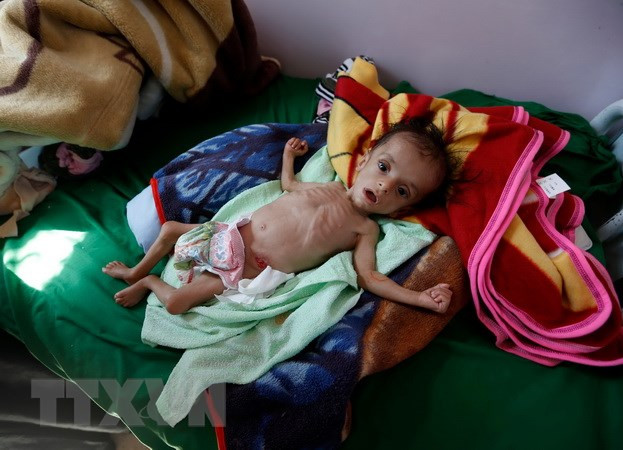 Cảnh báo về vòng luẩn quẩn của đói nghèo và xung đột ảnh 2