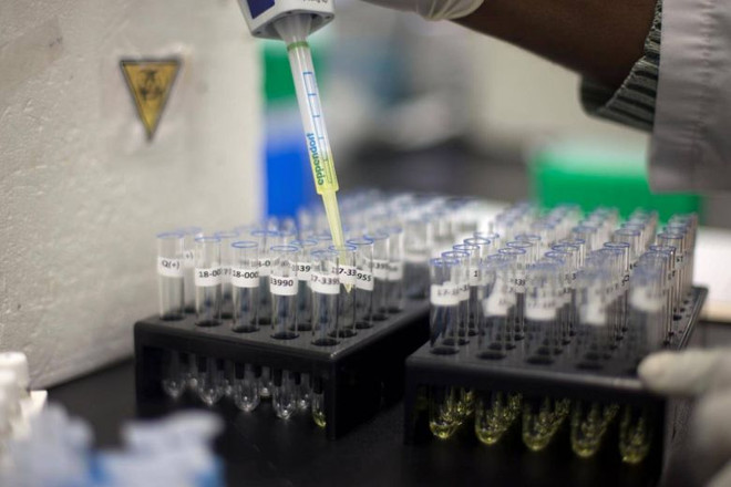 Nhật thử nghiệm phương pháp xét nghiệm nước tiểu phát hiện ung thư ảnh 1