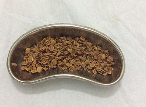 Lấy ra hơn 70 gr hạt sơri nảy mầm trong hậu môn bệnh nhi 11 tuổi ảnh 1