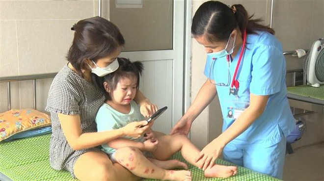 Số ca mắc tay chân miệng gia tăng, Bộ Y tế lập 7 đoàn kiểm tra ảnh 1