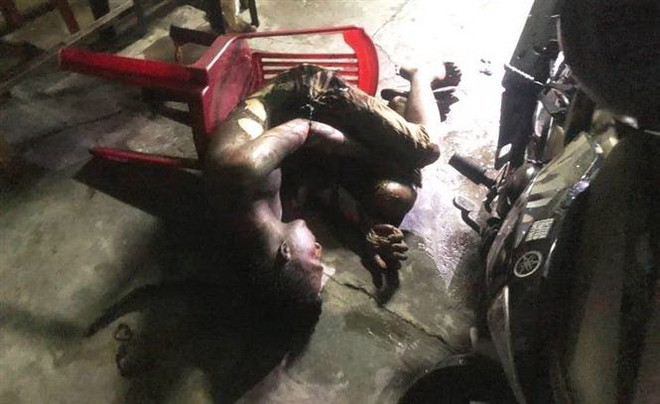 Nam thanh niên bị bỏng xăng sau khi lớn tiếng ở nhà bạn gái ảnh 1