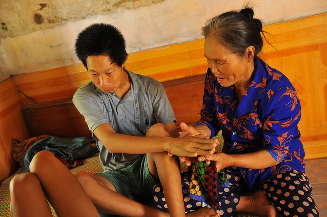 Khởi động Dự án chăm sóc sức khỏe đối với nạn nhân dioxin ảnh 1