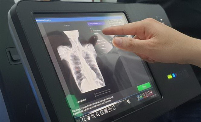 PGS.TS Lương Ngọc Khuê: Chuyển đổi Số trong lĩnh vực y tế còn quá chậm ảnh 2