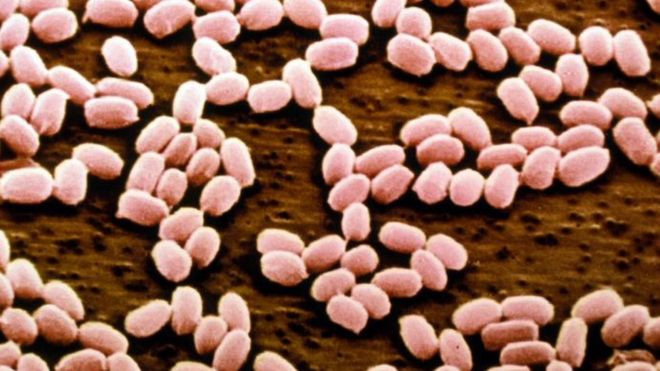 Nga: Bệnh than bùng phát khiến 1 người tử vong, 90 người nhập viện ảnh 1