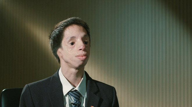 'Chàng trai không tai' và hành trình thắp lửa đam mê khoa học ảnh 2