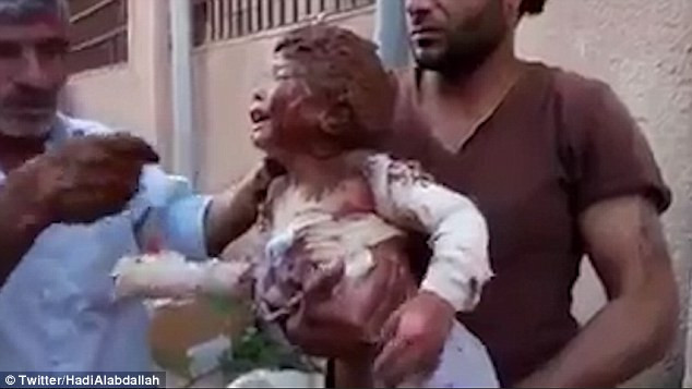 Thắt lòng trước cảnh dùng bùn chữa vết bỏng cho bé gái Syria ảnh 1