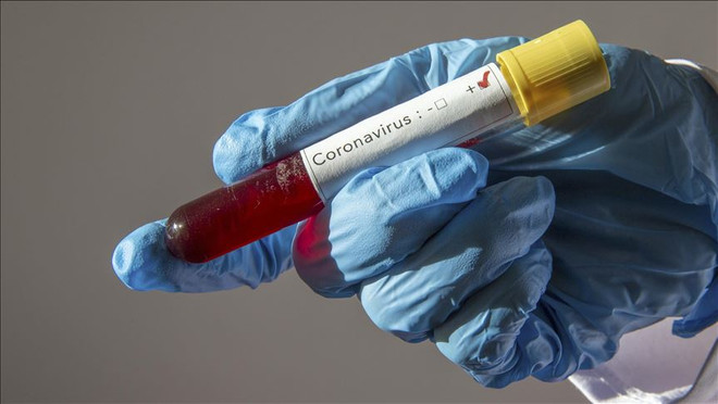 LHQ tạm thời đóng cửa văn phòng tại Zambia do nhân viên mắc COVID-19 ảnh 1