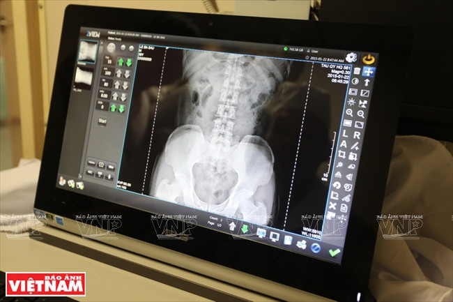 Tàu quân y HQ 561 - bệnh viện di động trên khu vực Biển Đông ảnh 7