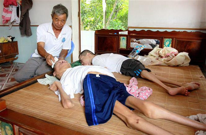 Một gia đình có 2 con bị nhiễm chất độc da cam. (Ảnh: Thế Duyệt/TTXVN) Xoa dịu nỗi đau của nạn nhân chất độc da cam thời hậu chiến ảnh 1