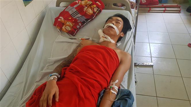 Bình Phước: Cứu sống bệnh nhân bị đâm thủng động mạch cảnh chung ảnh 1