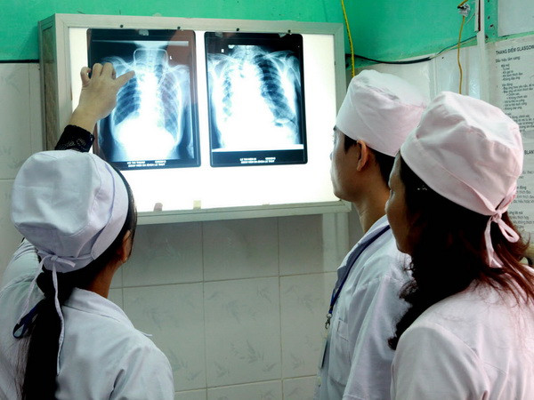 Ảnh minh họa. (Nguồn: TTXVN) Việt Nam có số bệnh nhân mắc nấm phổi xâm lấn cao nhất thế giới ảnh 1