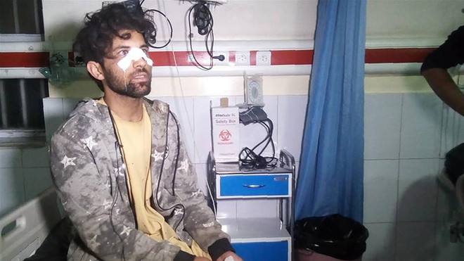 Đánh bom tại Kabul gần khu tổ hợp an ninh của Anh, 10 người chết ảnh 1