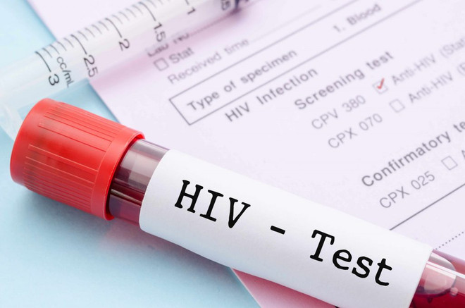 Tìm ra phương pháp xét nghiệm HIV mới cho kết quả nhanh nhất ảnh 1