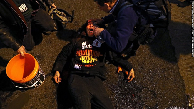 Cảnh sát Mỹ bắt hơn 90 người biểu tình chống lại ông Donald Trump ảnh 1