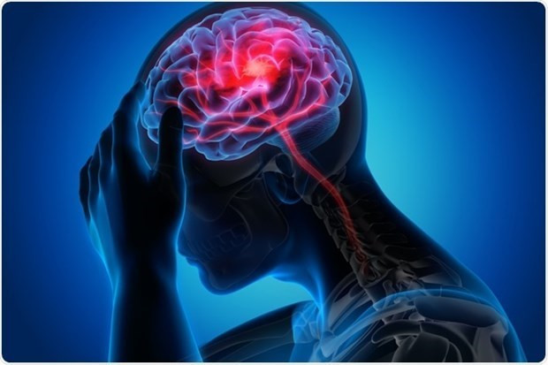 Ảnh minh họa. (Nguồn: Shutterstock.com) WHO cảnh báo tác động của dịch COVID-19 đến sức khỏe tâm thần ảnh 1