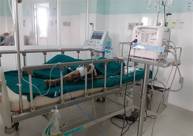 Bà Tô Thị Thanh Xuân được cấp cứu tại Bệnh viện Đa khoa tỉnh Kon Tum song đã tử vong do vết thương quá nặng. (Ảnh: TTXVN) Kon Tum: Điều tra vụ đổ xăng, châm lửa đốt khiến 2 người chết ảnh 1