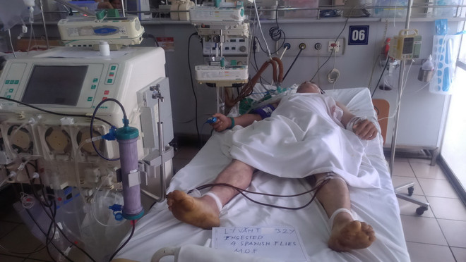 Một trường hợp ngộ độc sau khi ăn sâu ban miêu. (Nguồn: Bệnh viện Bạch Mai) sau ban mieu 2.jpg