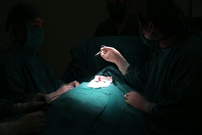 Tạo hình thành công cho một bé trai bị lún dương vật bẩm sinh ảnh 1