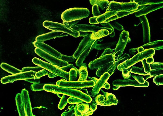 Mỹ công bố kết quả thử nghiệm lâm sàng đối với vaccine lao ảnh 1