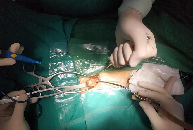 Bệnh nhi mắc bệnh Whitmore nguy hiểm bắt nguồn từ một vết ...phỏng ảnh 1