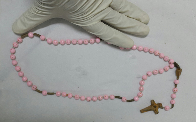 Nội soi, lấy chuỗi dây hạt từ thực quản của cụ bà hơn 70 tuổi ảnh 1