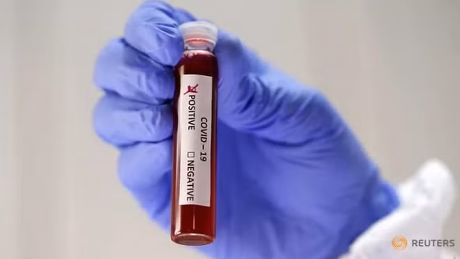 Phát hiện khí ozone có thể khử khuẩn bề mặt có virus SARS-CoV-2 ảnh 1