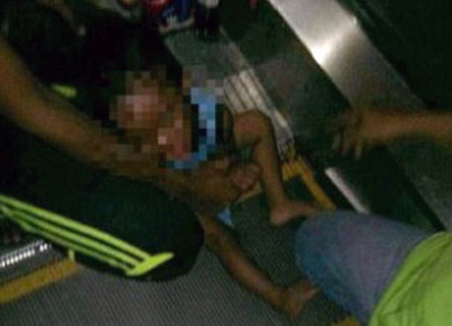 Kinh hoàng bé trai 3 tuổi bị thang cuốn nghiền nát bộ phận sinh dục ảnh 1