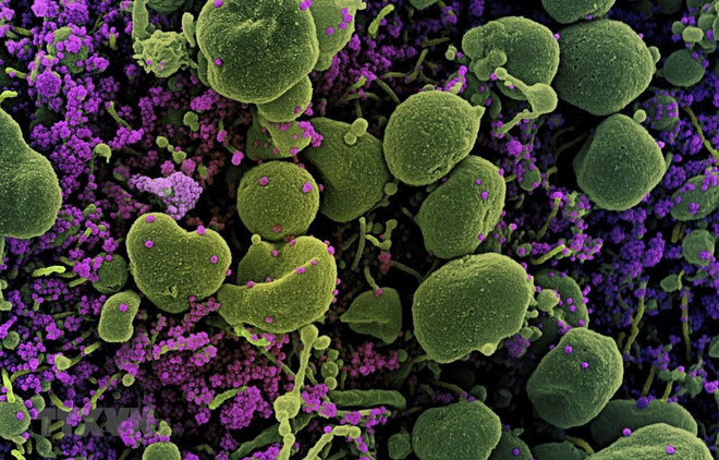 Anh: Đại học Oxford thử nghiệm tái nhiễm virus SARS-CoV-2 ảnh 1