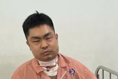 Đối tượng Lương Quí Lộc (SN 1993, trú tại phường 9, quận Gò Vấp, Thành phố Hồ Chí Minh) tại bệnh viện. (Ảnh: TTXVN phát)