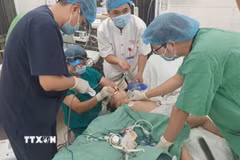 Kịp thời cứu sống bệnh nhi mắc hạt hướng dương đường thở. (Ảnh: TTXVN phát)