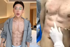 Cơ bụng nhân tạo của Andy Hao Tienan,. (Nguồn: odditycentral.com)