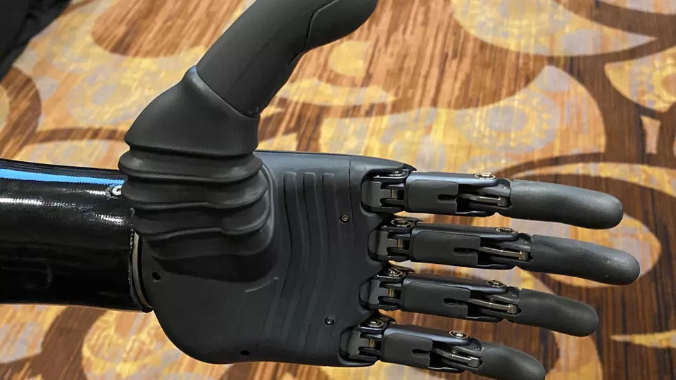 Tay giả BrainCo với công nghệ AI dành cho người khuyết tật. (Ảnh: Cnet)