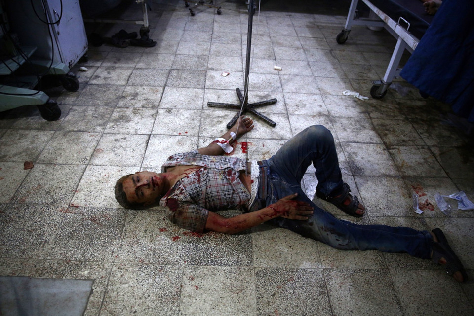 Một thanh niên bị thương nằm tại một bệnh viện dã chiến ở Douma, Syria. (Ảnh: AFP)