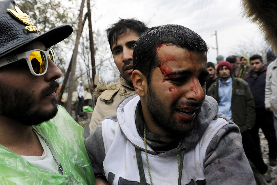 Người đàn ông này dùng dao cạo tự rạch mặt để đòi được nhập cảnh vào châu Âu. (Ảnh: Reuters)