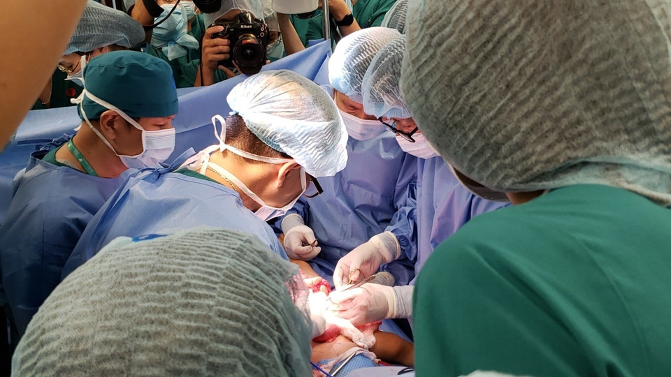 Hai bé sơ sinh Diệu Nhi và Trúc Nhi dính liền vùng bụng chậu, tứ chi đầy đủ, 2 cơ quan sinh dục, một hậu môn. (Ảnh: BV Nhi đồng TP.HCM)