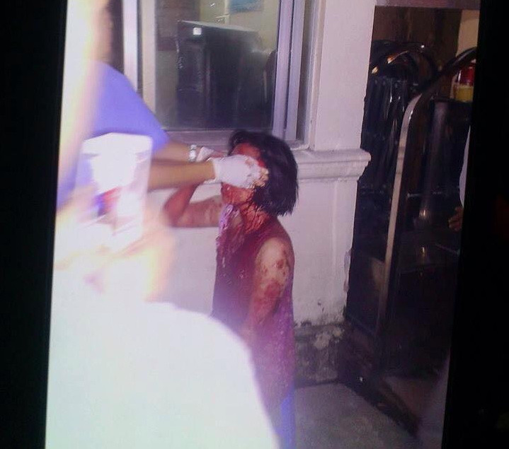 Một nạn nhân bị thương sau vụ nổ kinh hoàng. (Ảnh chụp màn hình một nhân chứng có mặt tại hiện trường)